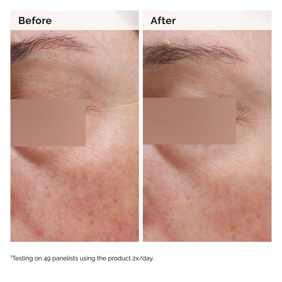 niacinamide-5-face-and-body-emulsion-s4 2024-08-23-ORD-Nia-5pct-Face-Body-B-A-Elasticity-Global-02-1x1.jpg