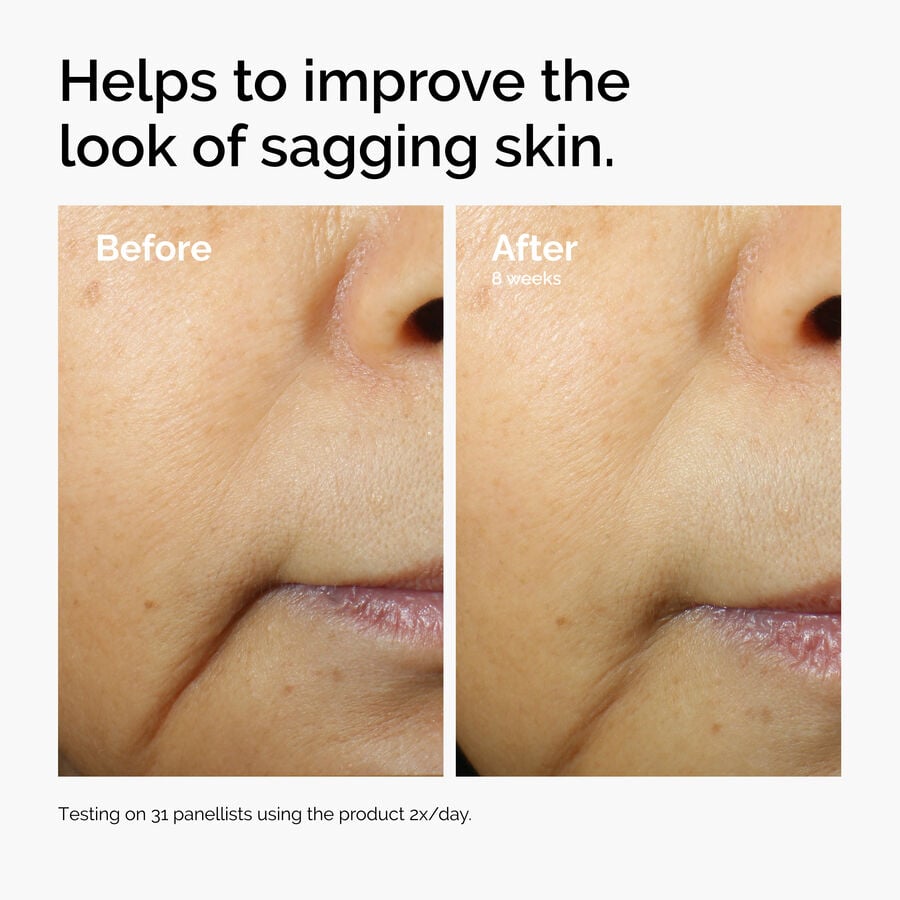 caffeine-3-escin-1-face-serum-l8 ord-caffeine-3pct-escin-1pct-face-serum-before-after-sagging.jpg