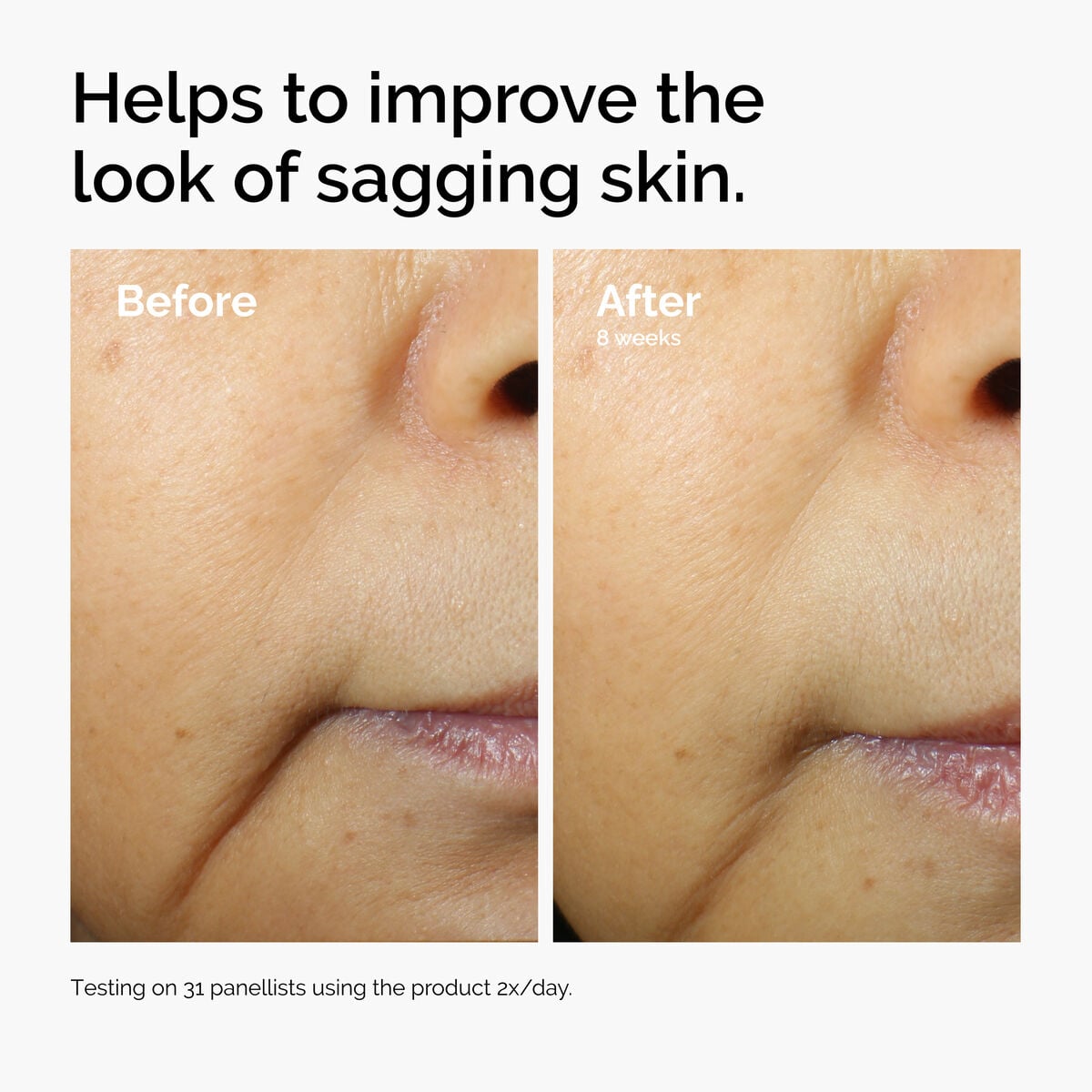 caffeine-3-escin-1-face-serum-l8 ord-caffeine-3pct-escin-1pct-face-serum-before-after-sagging.jpg