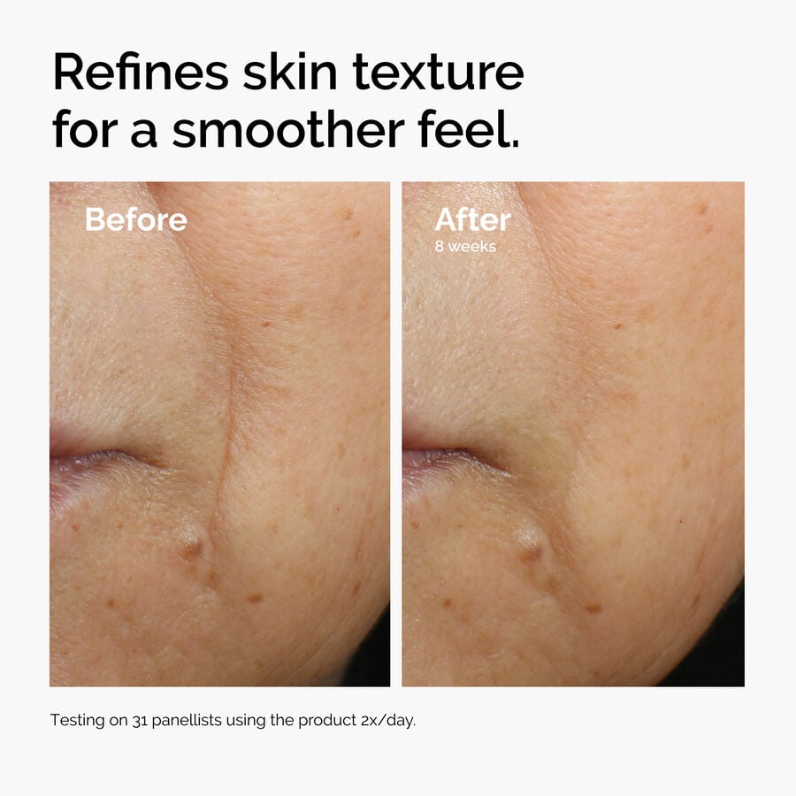 caffeine-3-escin-1-face-serum-l8 ord-caffeine-3pct-escin-1pct-face-serum-before-after-texture.jpg