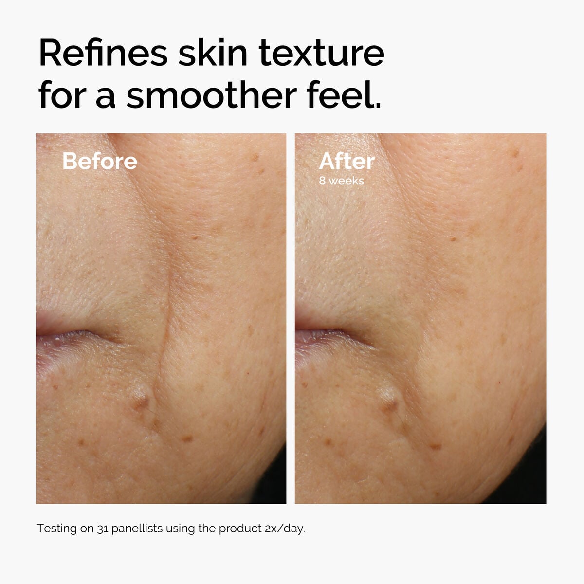 caffeine-3-escin-1-face-serum-l8 ord-caffeine-3pct-escin-1pct-face-serum-before-after-texture.jpg