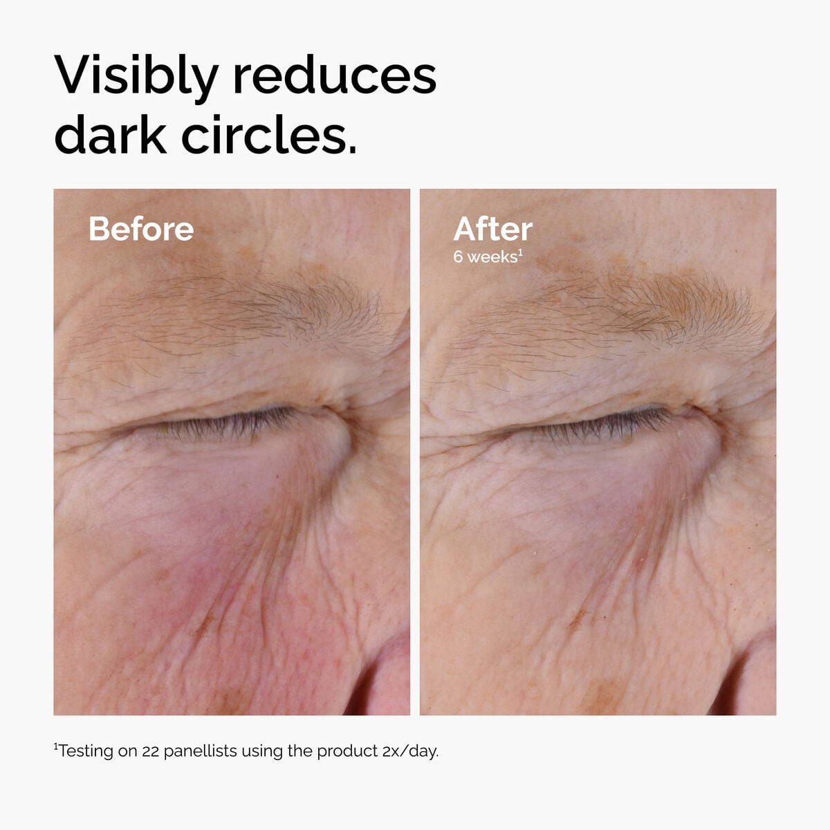 caffeine-solution-5-egcg-eye-serum-k9 ord-caffeine-solution-egcg-dark-circles-before-after.jpg