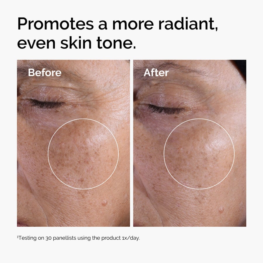 glycolic-acid-7-exfoliating-toner-f1 ord-glycolic-before-after-radiance.jpg