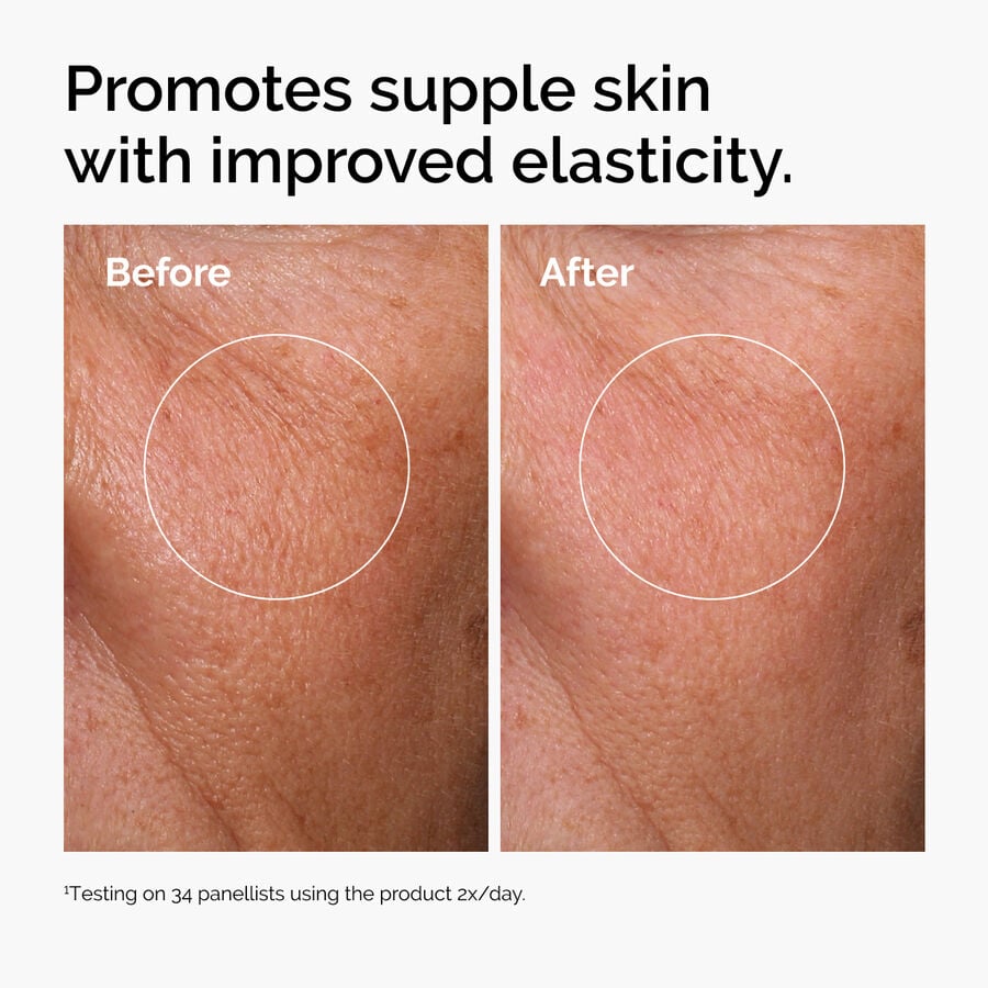 hyaluronic-acid-2-b5-with-ceramides-l2 ord-hyaluronic-acid-2pct-b5-hydrating-serum-before-after-elasticity.jpg