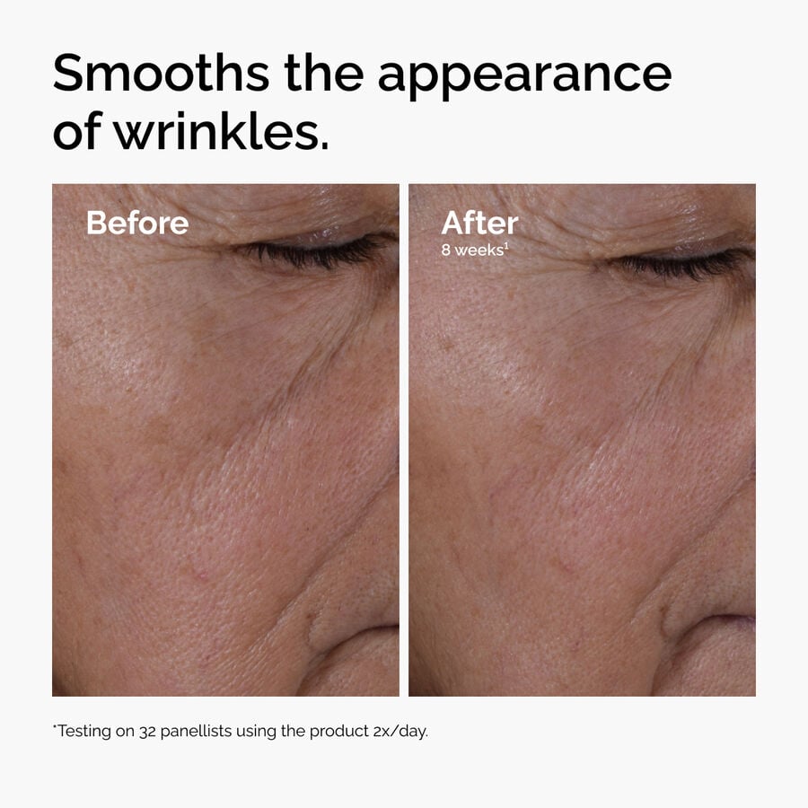 multi-peptide-ha-serum-t9 ord-multi-peptide-ha-serum-wrinkles-before-after.jpg