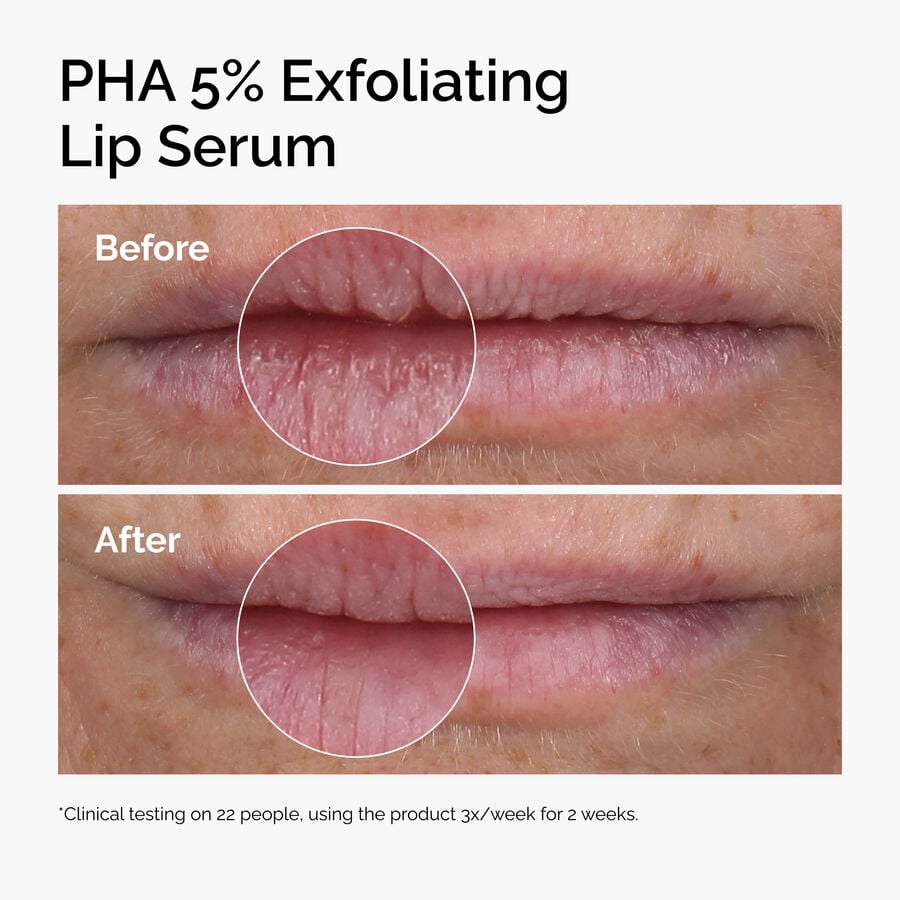 pha-5-exfoliating-lip-serum-w3 ord-pha-5pct-lip-exfoliating-serum-before-after.jpg