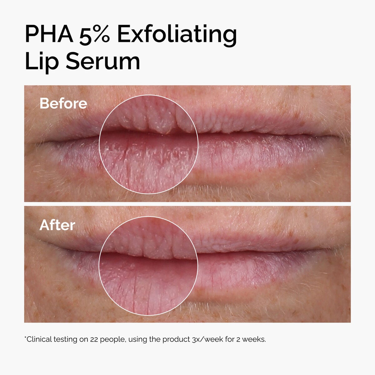 pha-5-exfoliating-lip-serum-w3 ord-pha-5pct-lip-exfoliating-serum-before-after.jpg